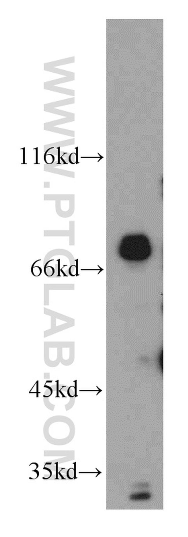 DNAJC2/MPP11 Antibody in Western Blot (WB)