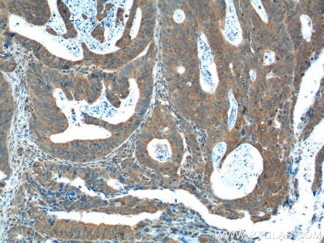 FANCA Antibody in Immunohistochemistry (Paraffin) (IHC (P))