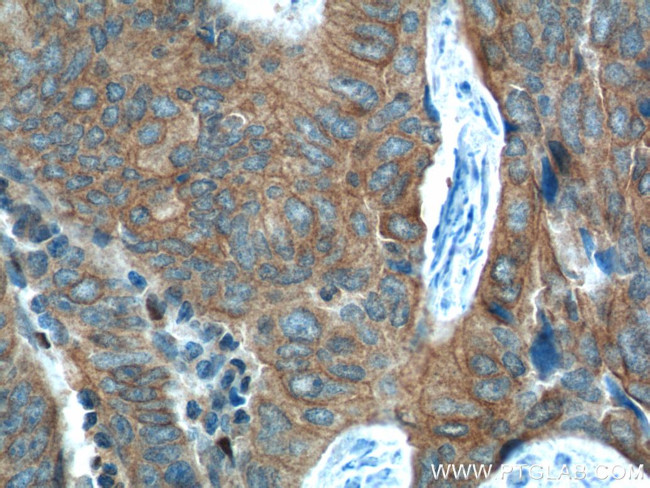 FANCA Antibody in Immunohistochemistry (Paraffin) (IHC (P))