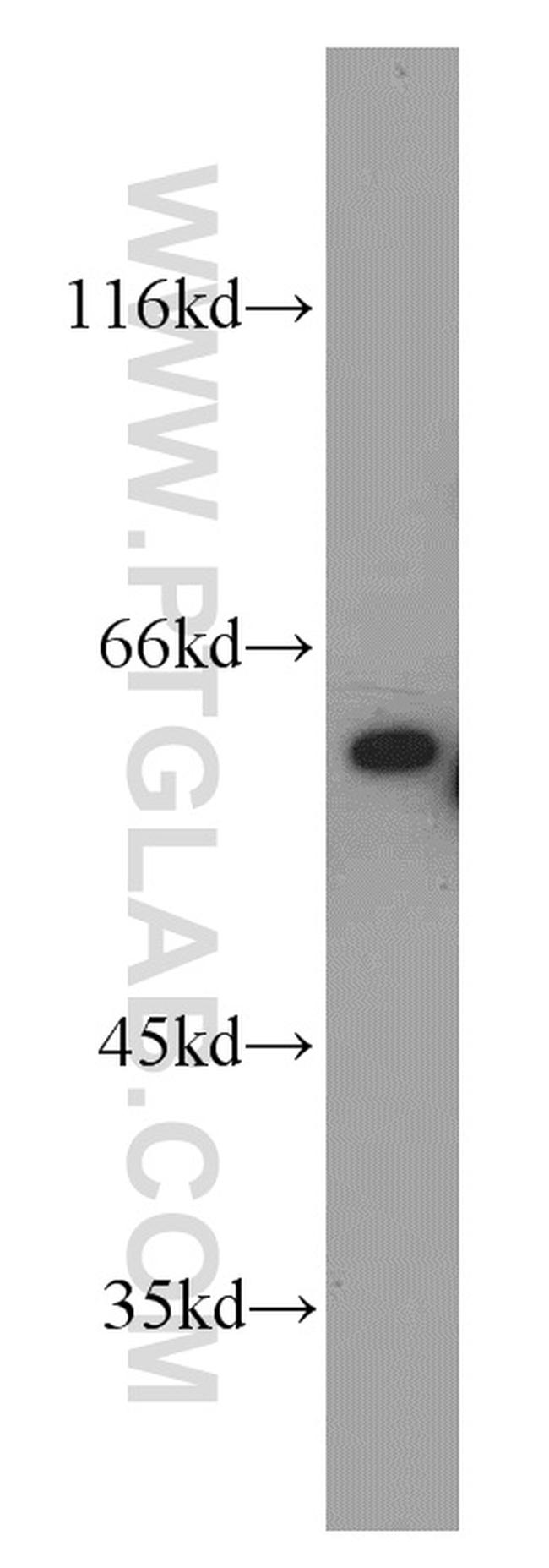 MLK3 Antibody in Western Blot (WB)