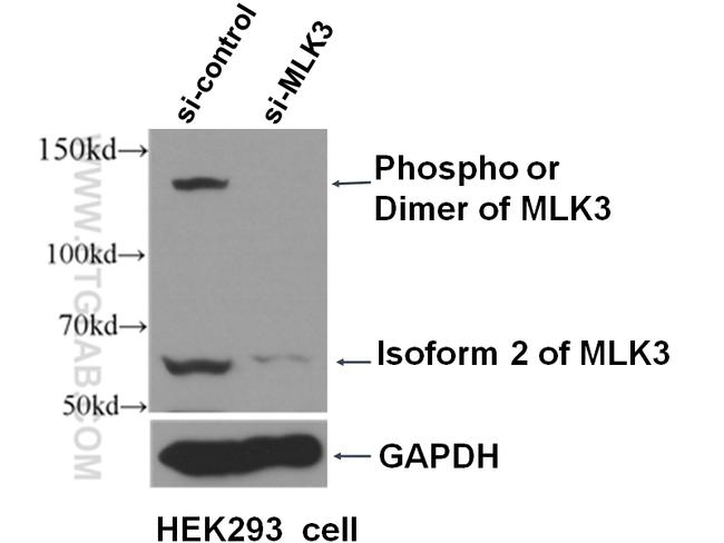 MLK3 Antibody in Western Blot (WB)