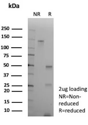 Alpha-1-Antichymotrypsin (SERPINA3) (Histiocytoma Marker) Antibody in SDS-PAGE (SDS-PAGE)