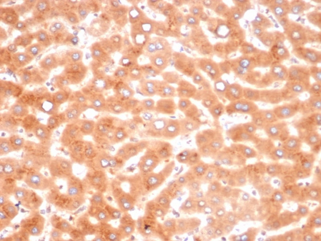 Alpha-1-Antichymotrypsin (SERPINA3) (Histiocytoma Marker) Antibody in Immunohistochemistry (Paraffin) (IHC (P))