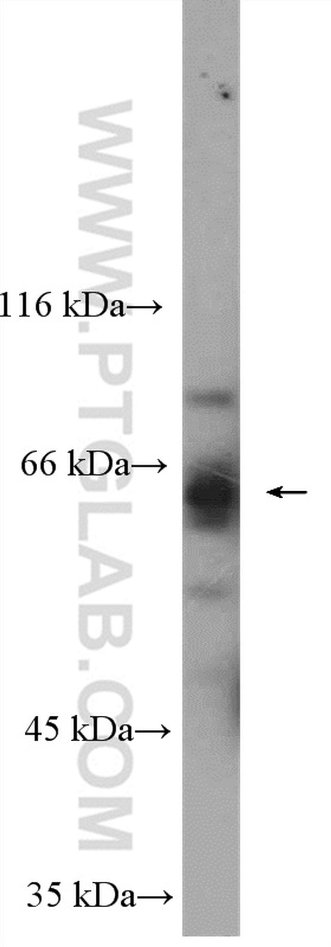 VPS45 Antibody in Western Blot (WB)