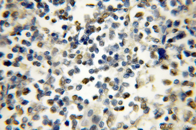 IKZF1 Antibody in Immunohistochemistry (Paraffin) (IHC (P))