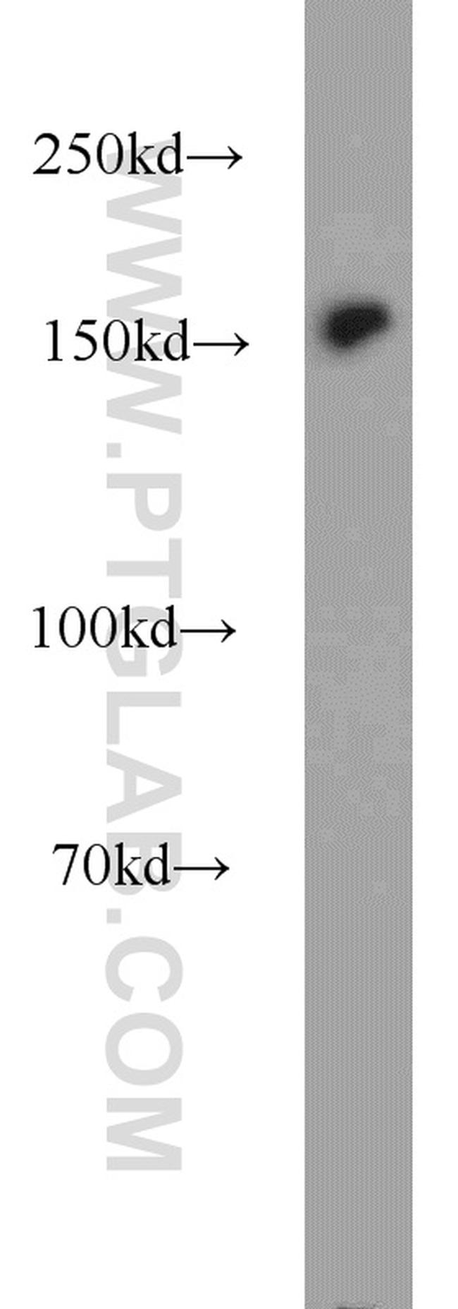 BAF170 Antibody in Western Blot (WB)