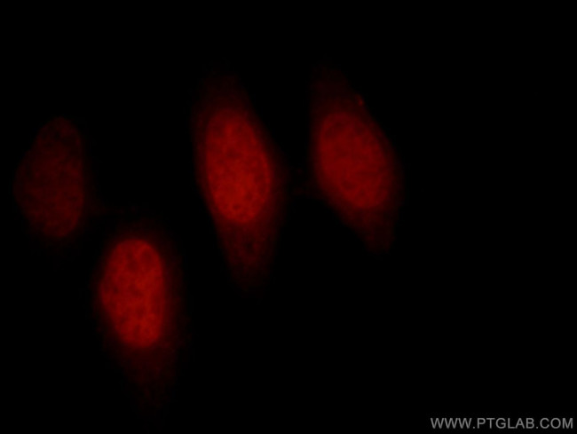 BAF170 Antibody in Immunocytochemistry (ICC/IF)