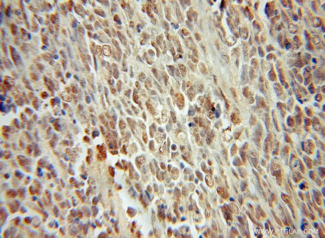 BAF170 Antibody in Immunohistochemistry (Paraffin) (IHC (P))