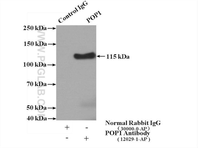 POP1 Antibody in Immunoprecipitation (IP)