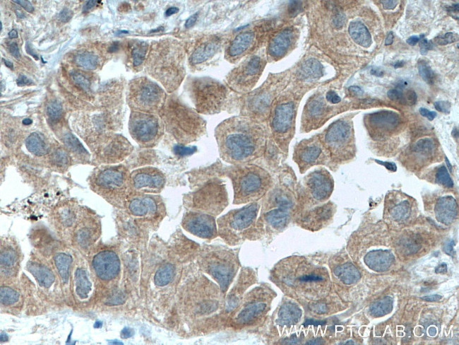 DVL2 Antibody in Immunohistochemistry (Paraffin) (IHC (P))