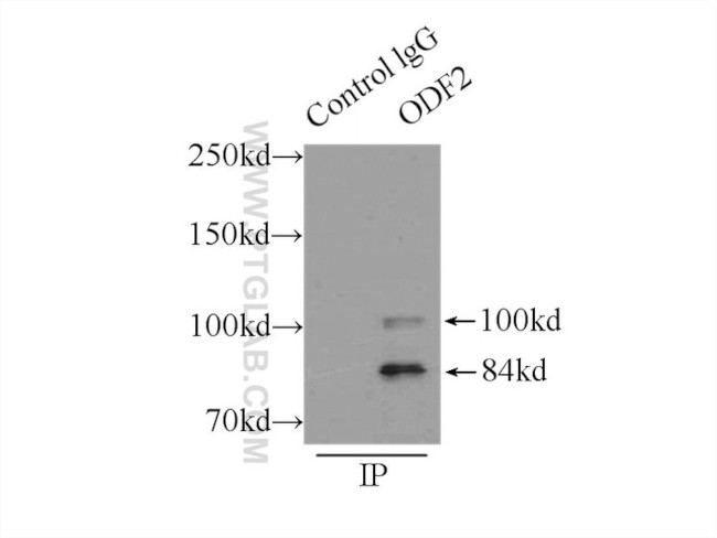 ODF2 Antibody in Immunoprecipitation (IP)