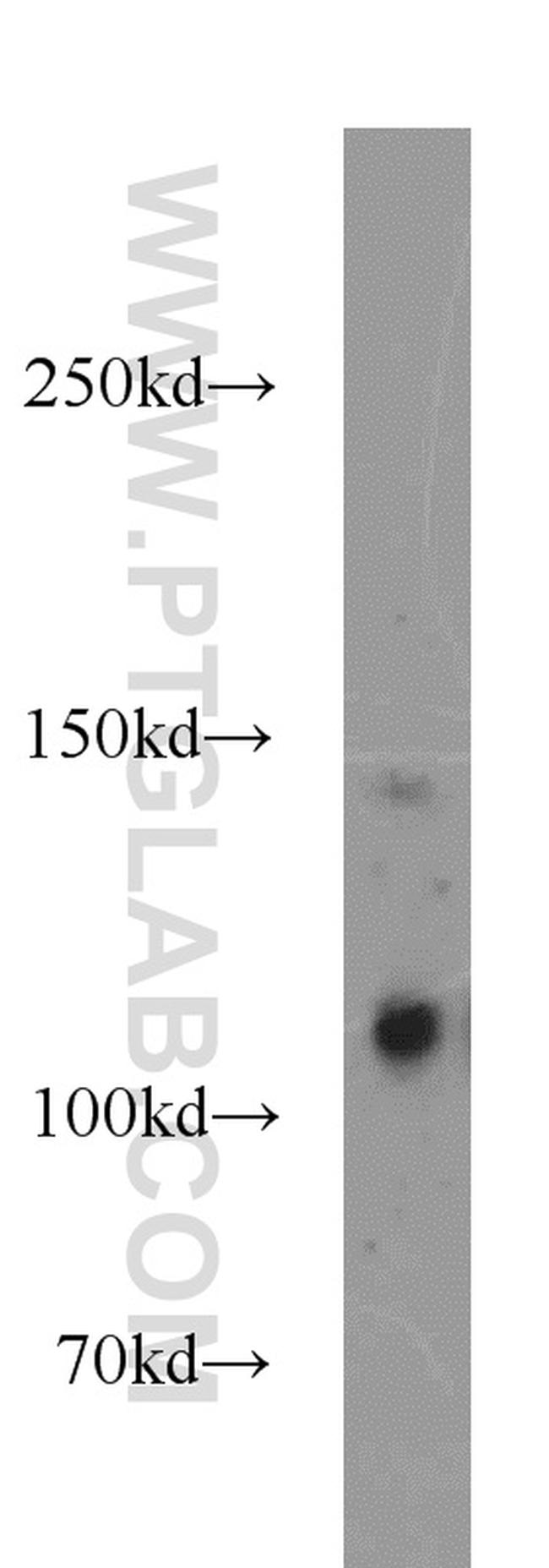 CDA1 Antibody in Western Blot (WB)