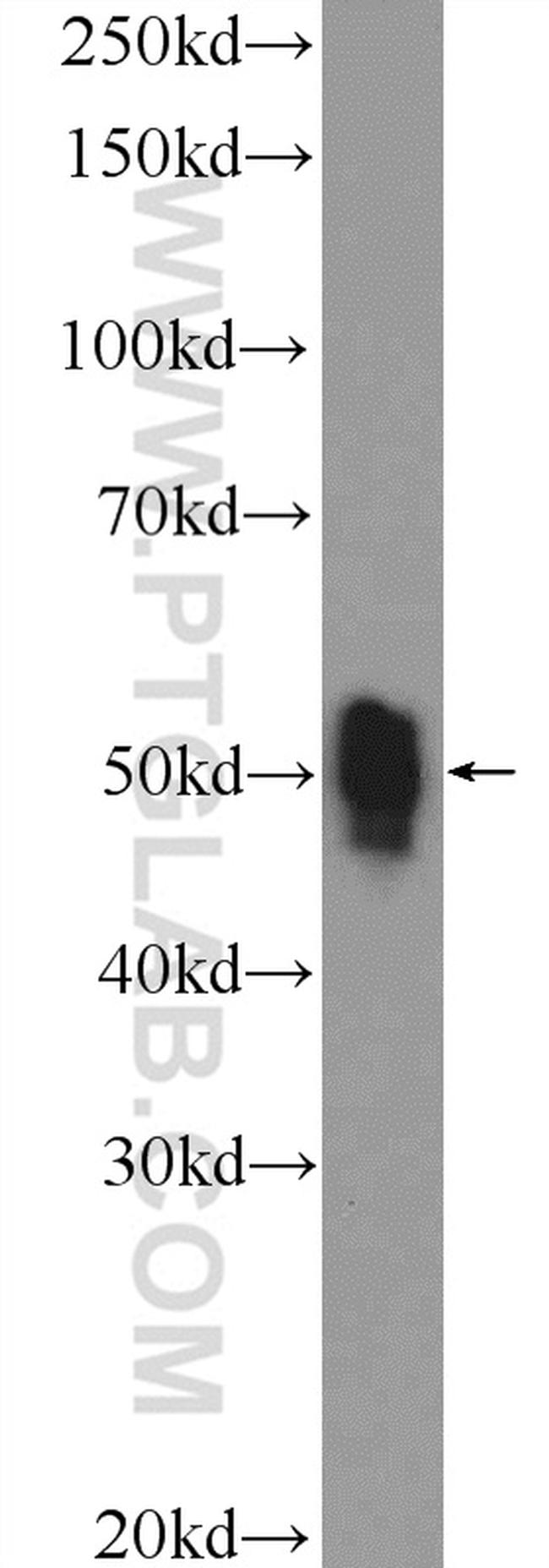 ETS1 Antibody in Western Blot (WB)