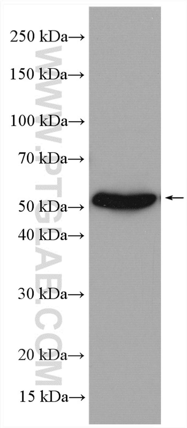 SLC16A5 Antibody in Western Blot (WB)