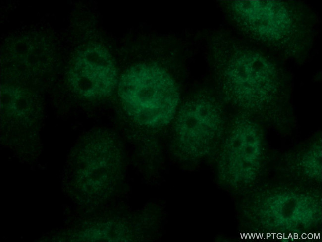 KIF2C Antibody in Immunocytochemistry (ICC/IF)