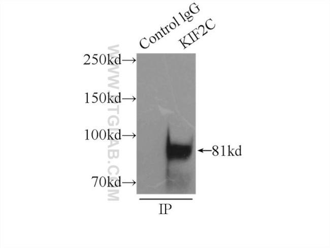 KIF2C Antibody in Immunoprecipitation (IP)