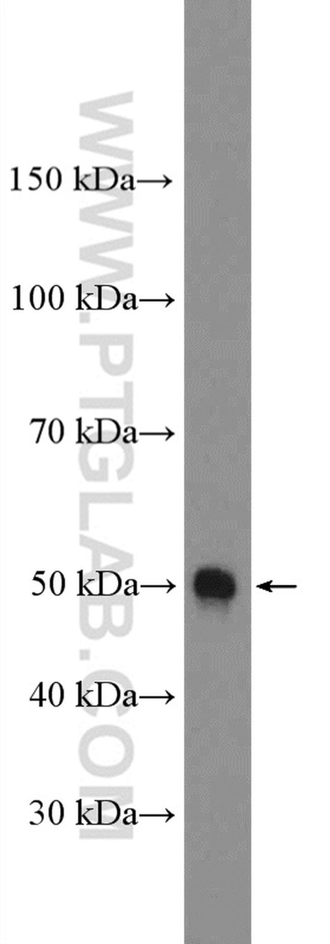 PAR2 Antibody in Western Blot (WB)
