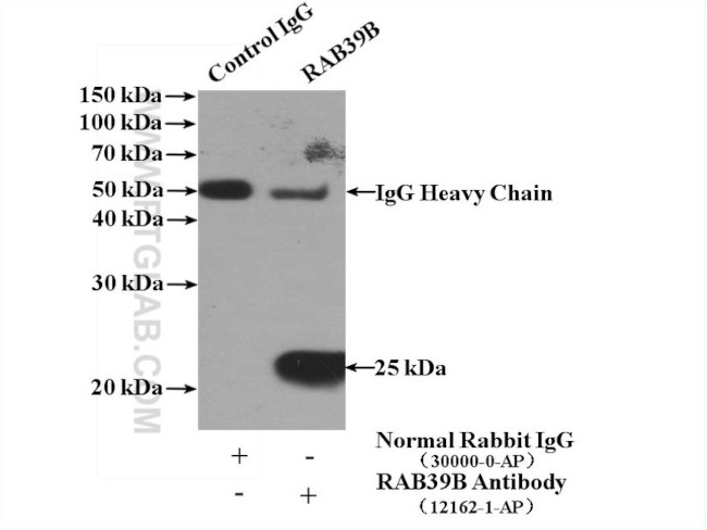 RAB39B Antibody in Immunoprecipitation (IP)