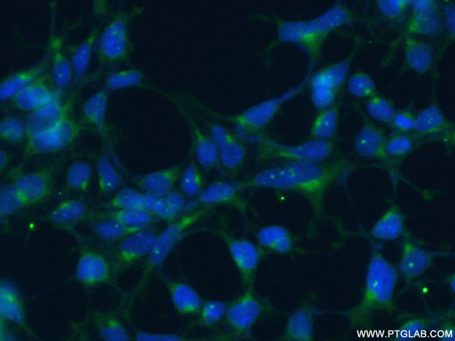 GOPC Antibody in Immunocytochemistry (ICC/IF)