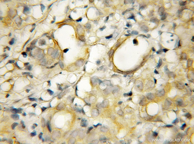 GOPC Antibody in Immunohistochemistry (Paraffin) (IHC (P))