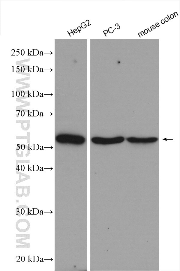 GOPC Antibody in Western Blot (WB)