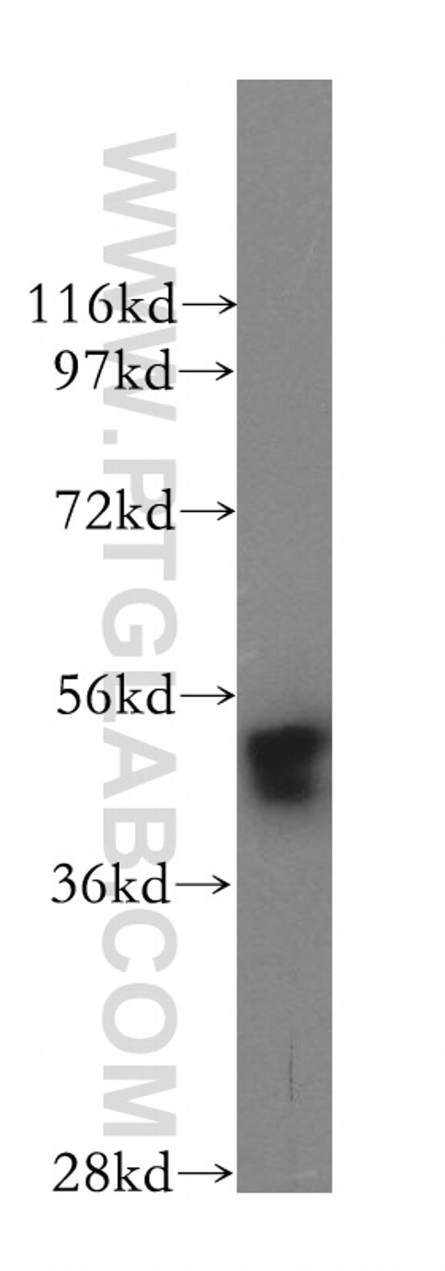 GOPC Antibody in Western Blot (WB)