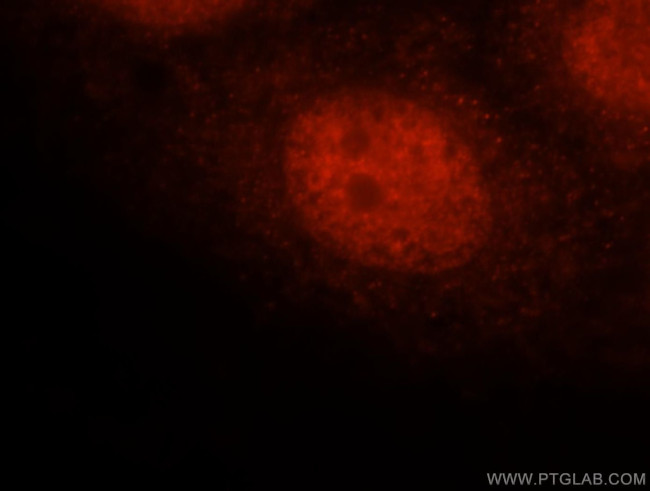 FAM107A Antibody in Immunocytochemistry (ICC/IF)