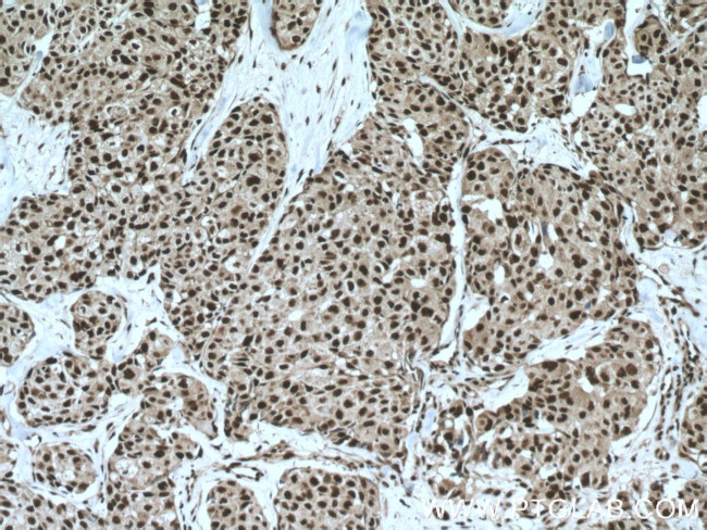 FAM107A Antibody in Immunohistochemistry (Paraffin) (IHC (P))