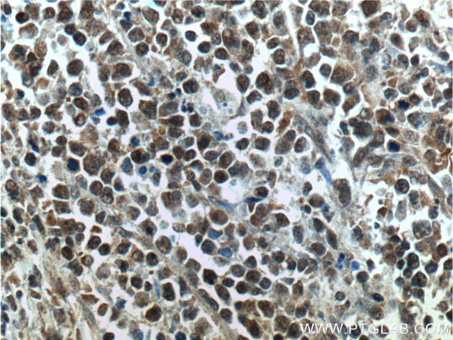 SMNDC1 Antibody in Immunohistochemistry (Paraffin) (IHC (P))