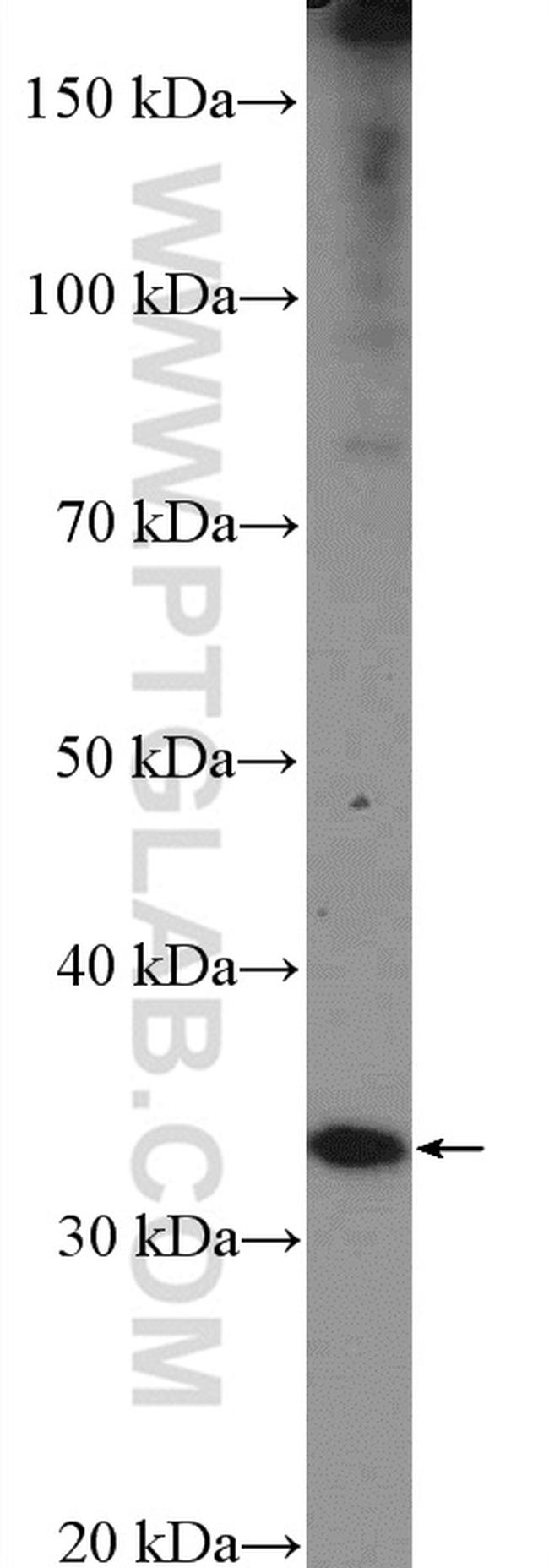 SMNDC1 Antibody in Western Blot (WB)