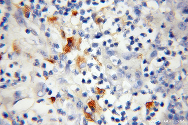 TOMM34 Antibody in Immunohistochemistry (Paraffin) (IHC (P))