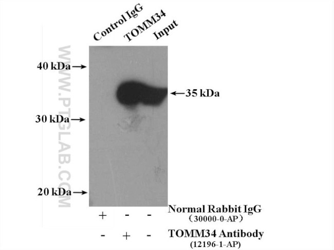 TOMM34 Antibody in Immunoprecipitation (IP)