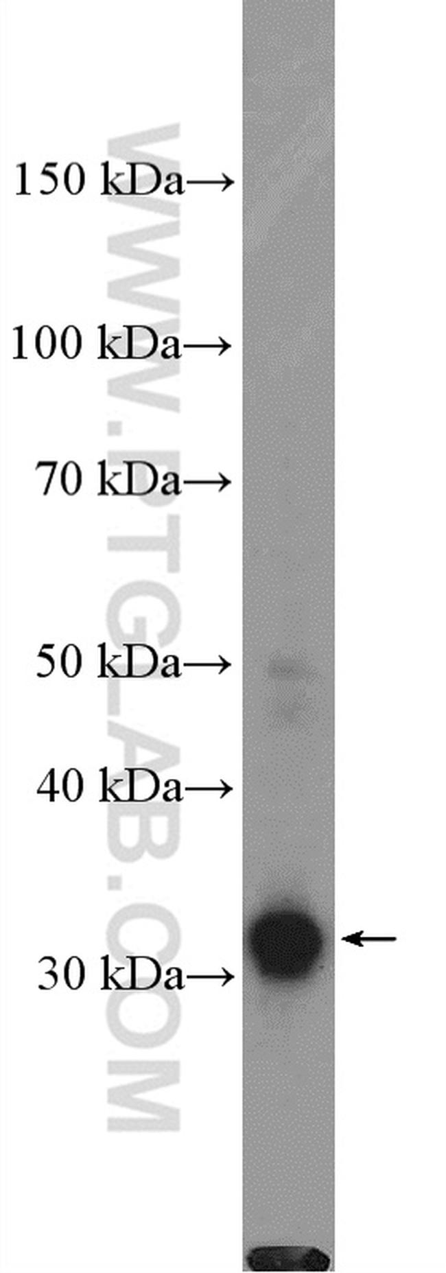 TOMM34 Antibody in Western Blot (WB)