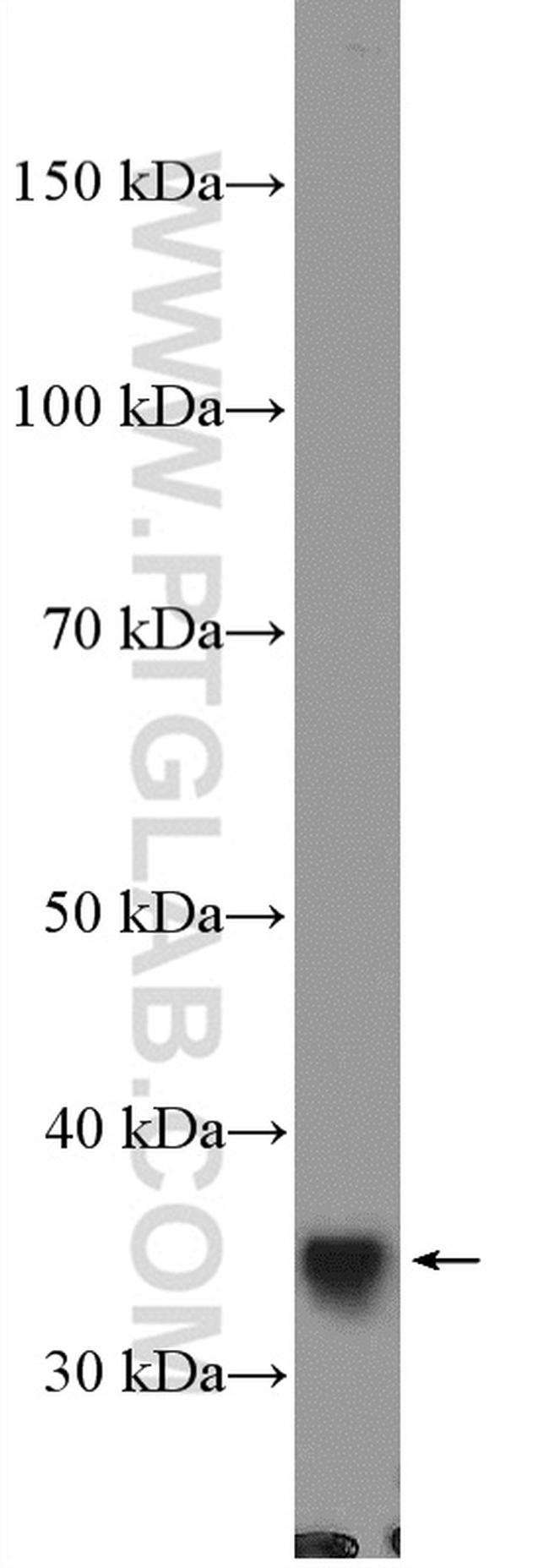 TOMM34 Antibody in Western Blot (WB)