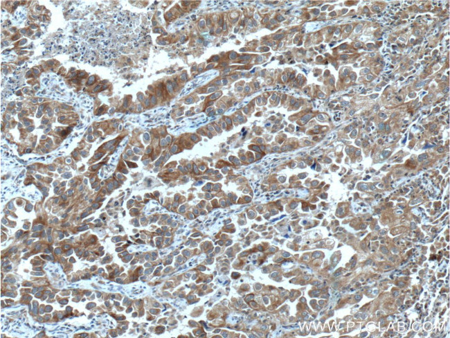 USP25 Antibody in Immunohistochemistry (Paraffin) (IHC (P))