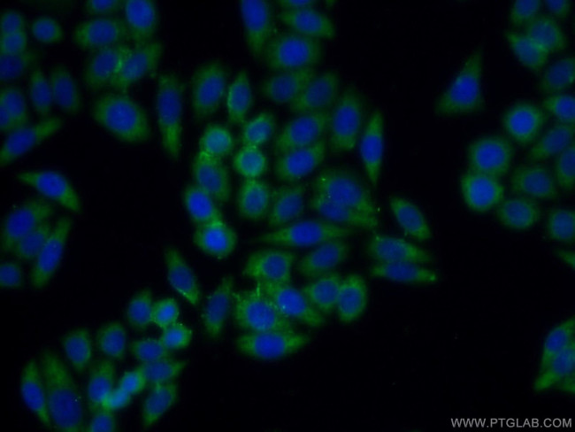 BMP7 Antibody in Immunocytochemistry (ICC/IF)