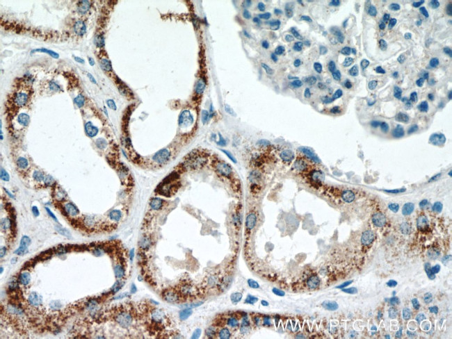 CHURC1 Antibody in Immunohistochemistry (Paraffin) (IHC (P))