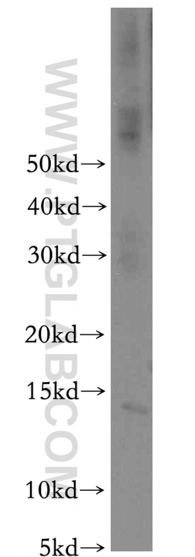 CHURC1 Antibody in Western Blot (WB)