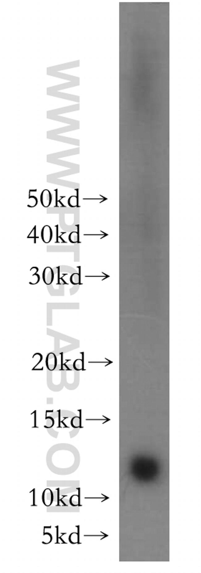 CHURC1 Antibody in Western Blot (WB)