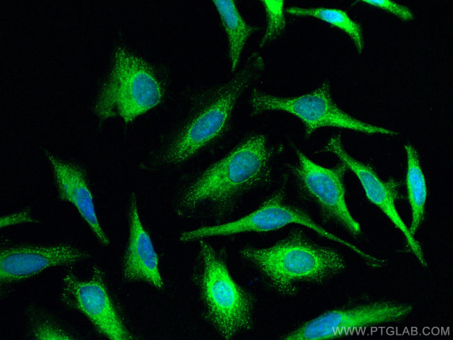 Calpastatin Antibody in Immunocytochemistry (ICC/IF)