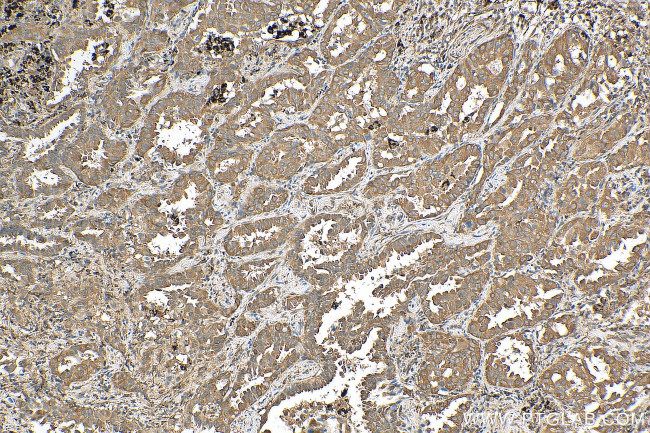 Calpastatin Antibody in Immunohistochemistry (Paraffin) (IHC (P))