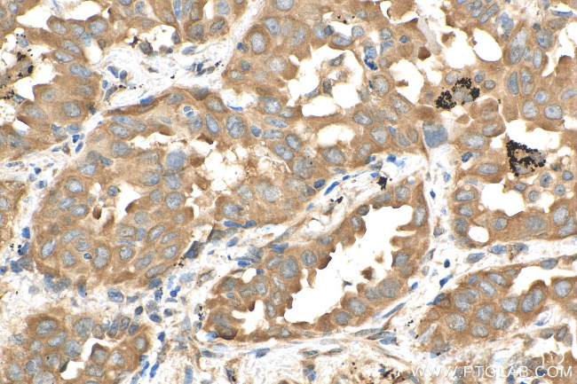 Calpastatin Antibody in Immunohistochemistry (Paraffin) (IHC (P))