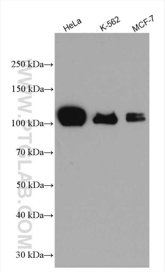 Calpastatin Antibody in Western Blot (WB)