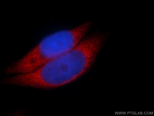 Calpastatin Antibody in Immunocytochemistry (ICC/IF)