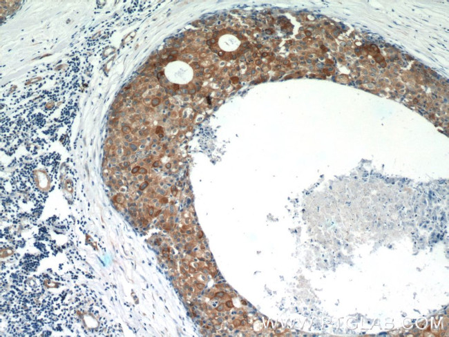 Calpastatin Antibody in Immunohistochemistry (Paraffin) (IHC (P))