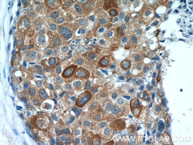 Calpastatin Antibody in Immunohistochemistry (Paraffin) (IHC (P))