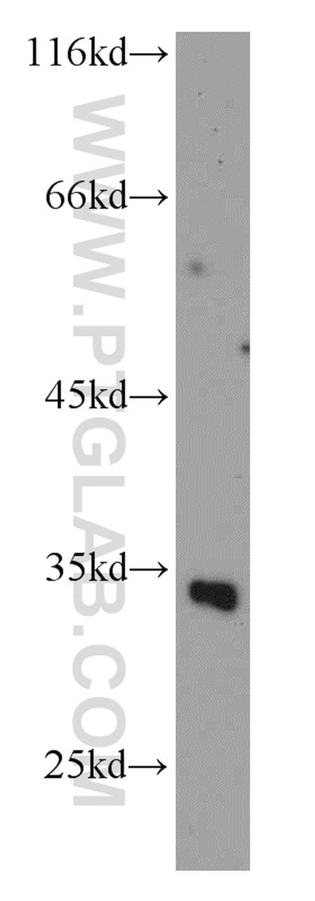 SLC25A11 Antibody in Western Blot (WB)