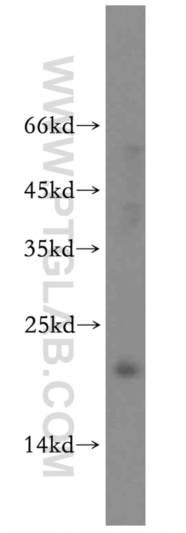 POLR1D Antibody in Western Blot (WB)