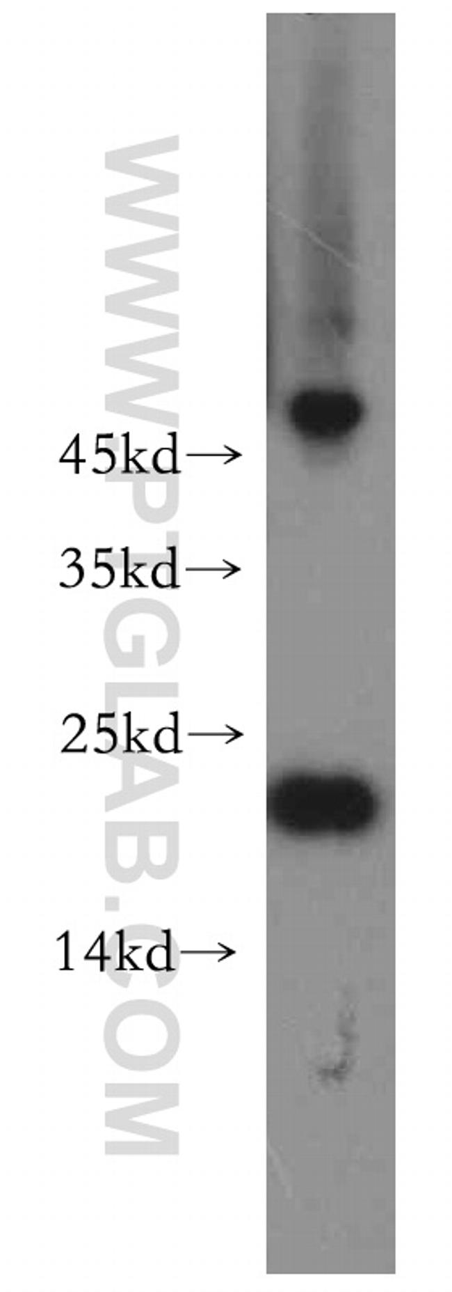 POLR1D Antibody in Western Blot (WB)