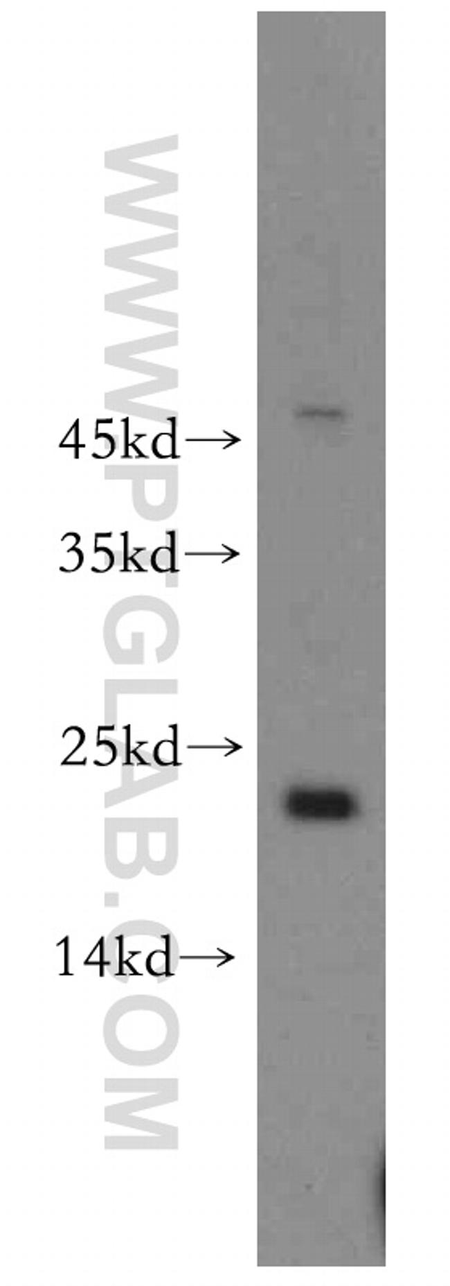 POLR1D Antibody in Western Blot (WB)